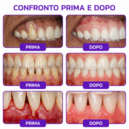 Rolimey® VioCore – Dentifricio al veleno d’api per gengivite e parodontite