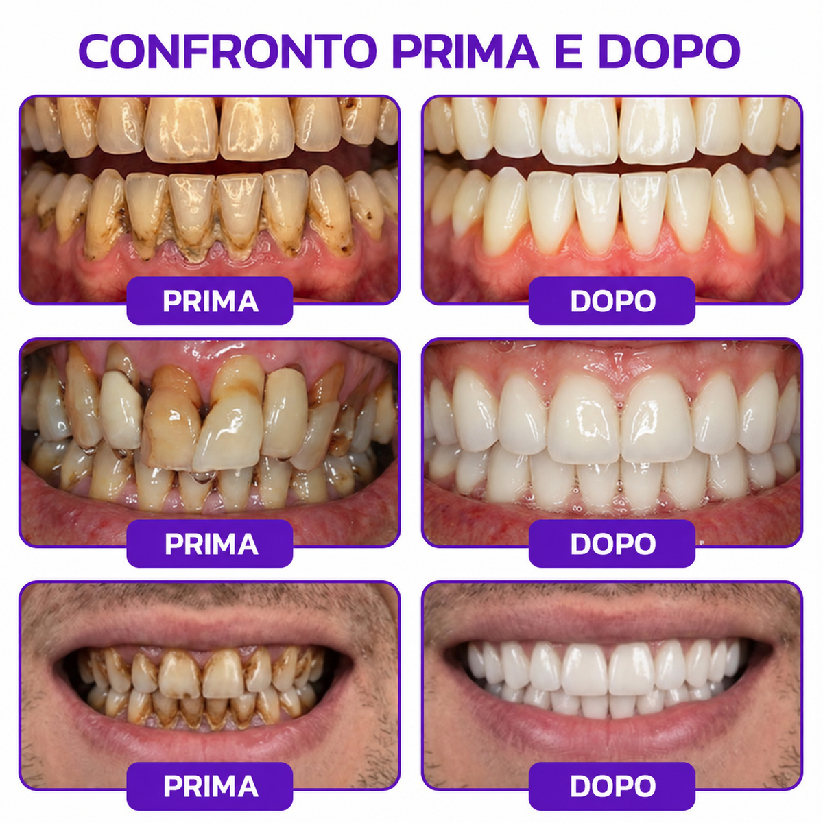 Rolimey® VioCore – Dentifricio al veleno d’api per gengivite e parodontite