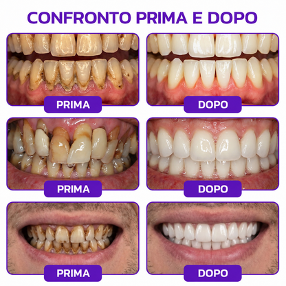 Rolimey® VioCore – Dentifricio al veleno d’api per gengivite e parodontite