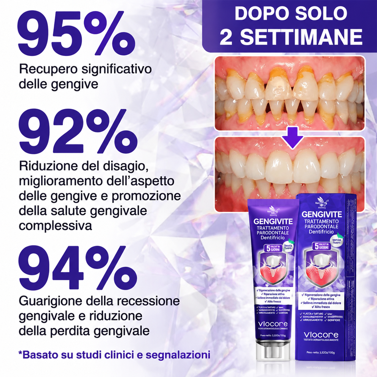 Rolimey® VioCore – Dentifricio al veleno d’api per gengivite e parodontite